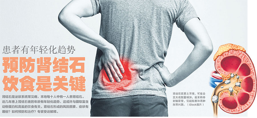 预防肾结石 Tan Tock Seng Hospital