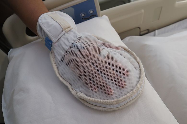 The new mitten has a zip to allow nurses to access a patient’s fingers to take