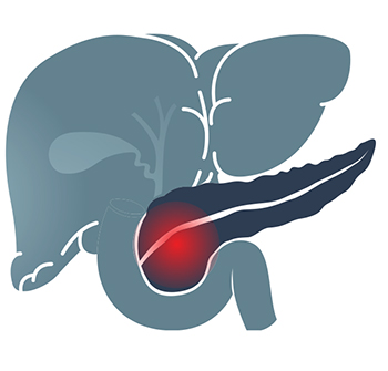 The-Inflamed-Pancreas-6.jpg