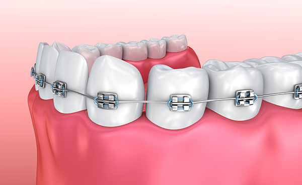 Orthodontics3.jpg