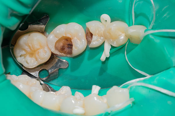 Endodontics-2.jpg