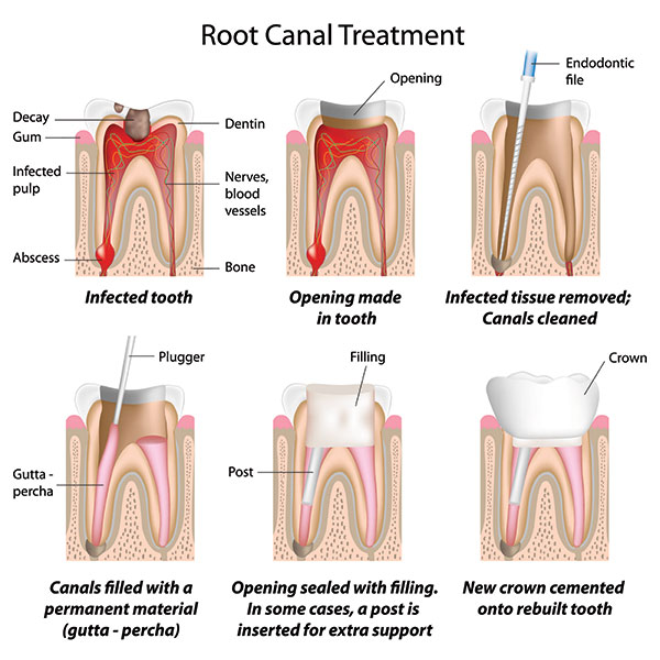 Endodontics-3.jpg