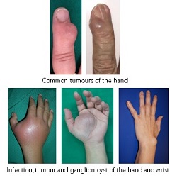 Hand1.jpg