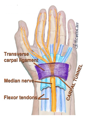 Carpal Tunnel Syndrome (CTS) and Its Treatment Options