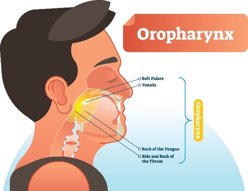Oropharyngeal Cancer 1.jpg