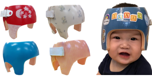 Plagiocephaly 5.png