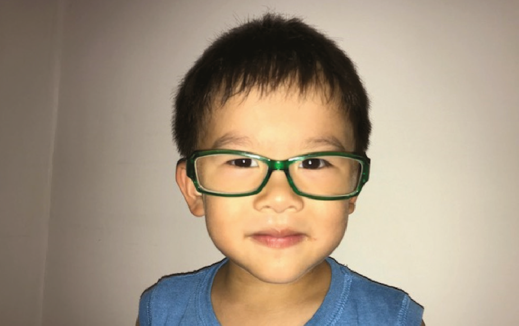 Refractive Error In Children 2-01.png