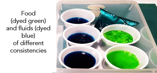 Swallowing - Fibreoptic Endoscopic Evaluation of Swallowing (FEES) 2.png