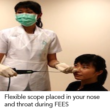 Swallowing - Fibreoptic Endoscopic Evaluation of Swallowing (FEES) 3.png