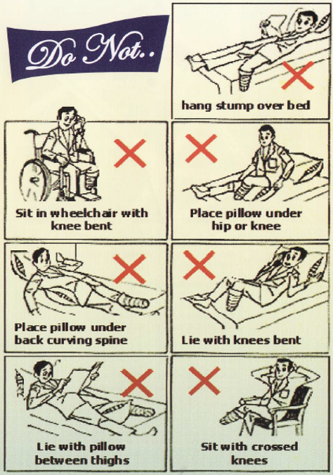 a guide for below knee amputees 2.PNG