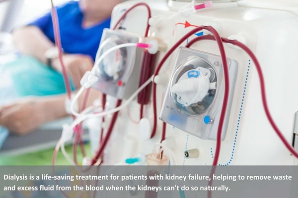 interim dialysis.jpg