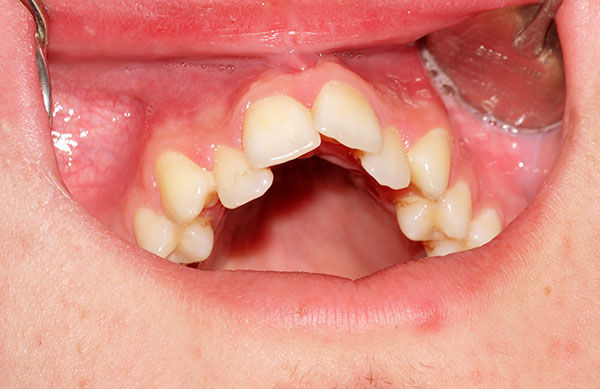 Orthodontics2.jpg