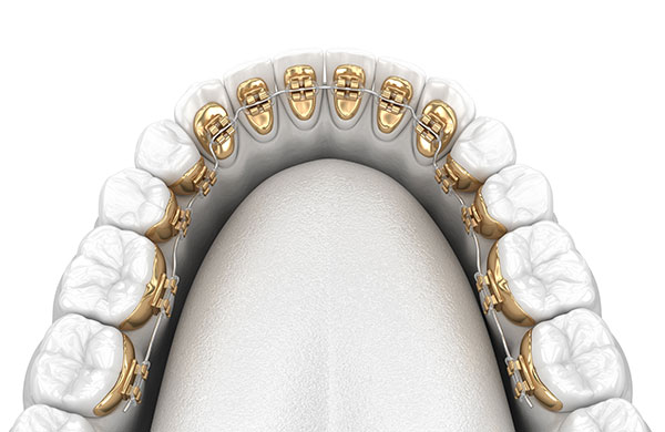 Orthodontics6.jpg