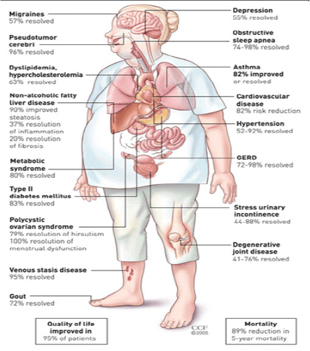 Benefits-of-bariatric-surgery.png