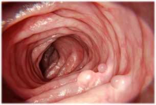 Constipation image_02.png