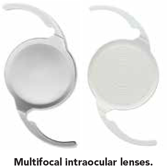 Intraocular Lenses And Refractive Options 2-01.png