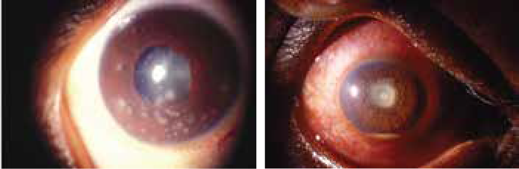 NHG_DLbrochure_Anterior Uveitis_V11 2-01.png